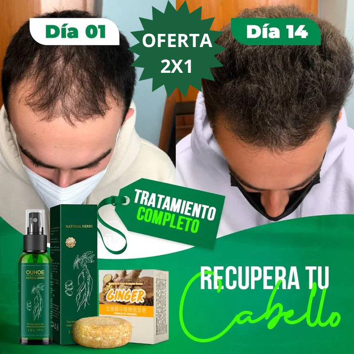 Recupera tu cabello, tu confianza y tu esencia con OUHOE