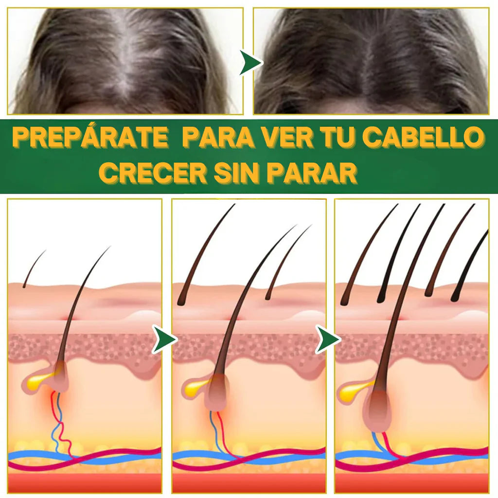 Recupera tu cabello, tu confianza y tu esencia con OUHOE