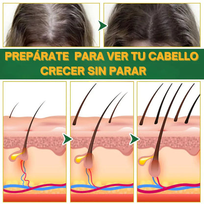 Recupera tu cabello, tu confianza y tu esencia con OUHOE